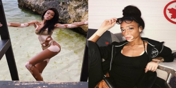 Winnie Harlow: a beleza real que conquistou a moda e redefiniu padrões nas passarelas